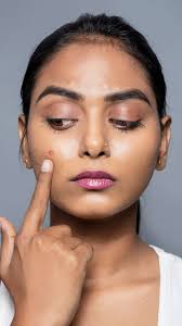 5 expert tips to avoid seasonal acne