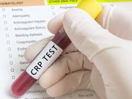 C Reactive Protein Crp Test High Levels Low Levels And