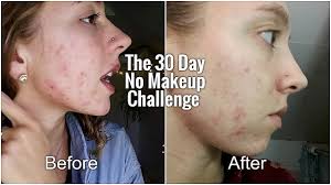30 day no makeup challenge before and
