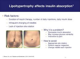 Updates In Insulin Delivery For People With Diabetes Ppt