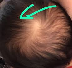 soft p on back of baby s head june