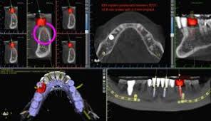 cone beam ct scan cbct