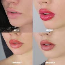 lip blushing treatment service at best