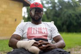 A traffic stop ended in a Gainesville Police K9 ripping out his eye.  Terrell Bradley's story is more than the police report - WUFT News