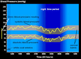 Normal Diurnal Variation In Pressure With A Nocturnal Dip