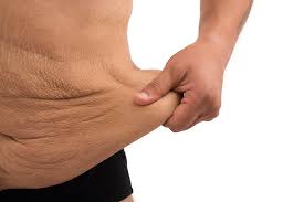 what is excess skin removal surgery