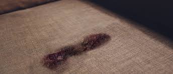 how to remove blood stains from your sofa