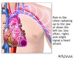 The pain is related to moving or pressing on a specific part of the chest wall, neck, or shoulder. Chest Pain Medlineplus Medical Encyclopedia