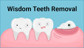 wisdom tooth extraction dentist open