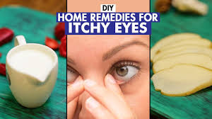 home remes for itchy eyes diy fit