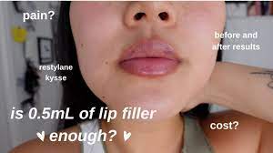 is 0 5ml of lip filler enough i