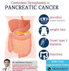 a guide to pancreatic cancer cancer