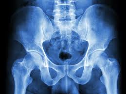 Check spelling or type a new query. X Ray Of The Pelvis Purpose Procedure And Risks