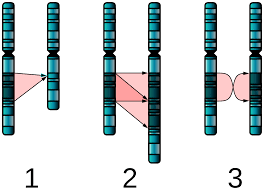 Chromosome Abnormality Wikipedia