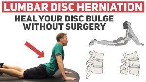 disc herniation without surgery