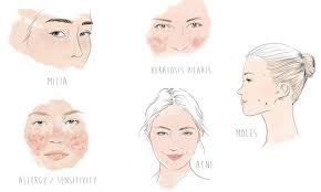 They are most often seen on the skin around the cheeks, nose, eyes and multiple eruptive milia. What Are Those Tiny Bumps On Your Face Dermstore Blog