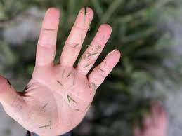 how to clean pine tree sap from skin