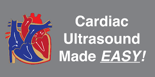 cardiac ultrasound echocardiography