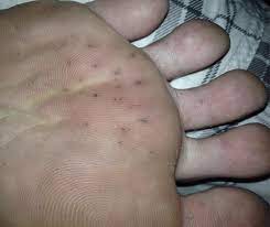 black dots on their foot mumsnet