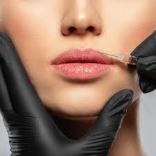 is a botox lip flip right for you