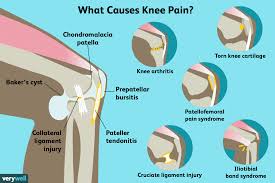 knee pain causes diagnosis and treatment
