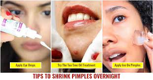 8 ways to shrink pimples overnight