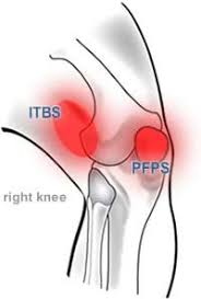 runners knee there are two kinds