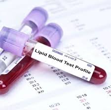 lipid blood tests and its index meaning