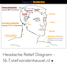 Diagram Of Head Pain Headache Location Chart Meaning