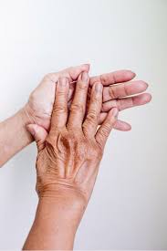 Joint pain is usually the earliest sign of arthritis in your fingers. Pin Di Arthritis Rheumatoid Osteoarthritis