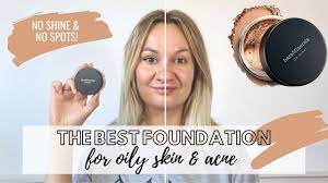 best foundation for acne oily skin