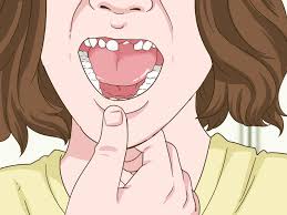 If you have recently been hit in the mouth and notice a tooth or two has become loose then you should see your dentist immediately. 4 Ways To Painlessly Pull Out A Loose Baby Tooth Wikihow
