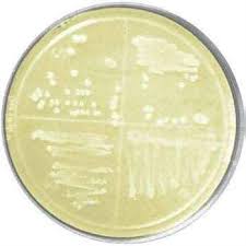 lb agar plates w neomycin