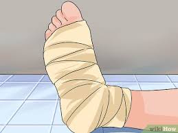 tape a foot for plantar fasciitis