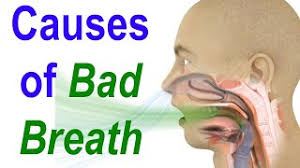 sources of bad breath or halitosis
