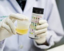 Foods That Affect Ph Levels In Urine