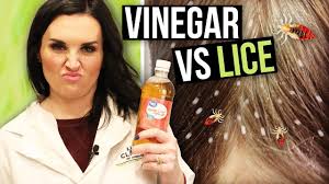 apple cider vinegar for head lice