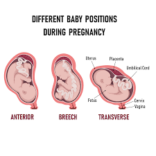 diffe baby positions in the womb