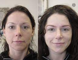 semi permanent makeup treatment