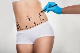 The Importance Of Diet Before And After A Tummy Tuck