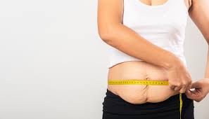 are you considering weight loss surgery