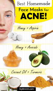 homemade face mask for acne treatment
