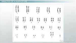 Karyotype Definition Disorders Analysis