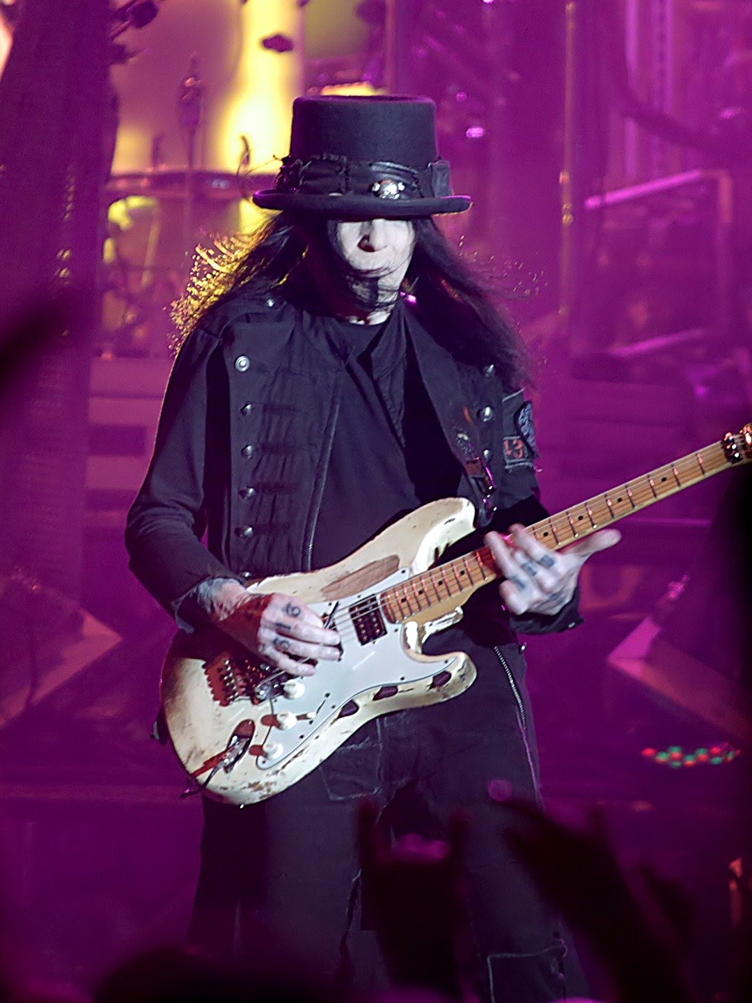 Mick Mars | Top 10 Celebrities with Spinal Injuries