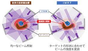 放射線医学センター （放射線科） | 診療科・部門紹介 | 東京西徳洲会病院