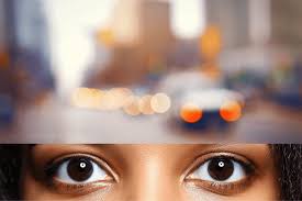 blurred vision causes symptoms and