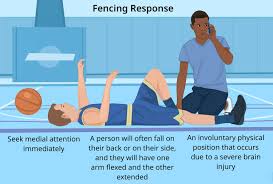 fencing response definition sports