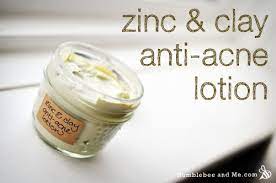 zinc clay anti acne lotion