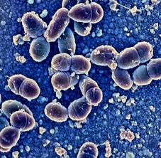 #listeria#monocytogenes#microbiology#virulencefactor#bacteriologyif you like ❤ this video please subscribe to med bees if you have any query or suggestion. Bakterien Was Erreger Verursachen Konnen Bilder Fotos Welt