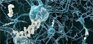 Alzheimer: Lecanemab verbessert in Phase-III-Studie kognitive  Beeinträchtigungen